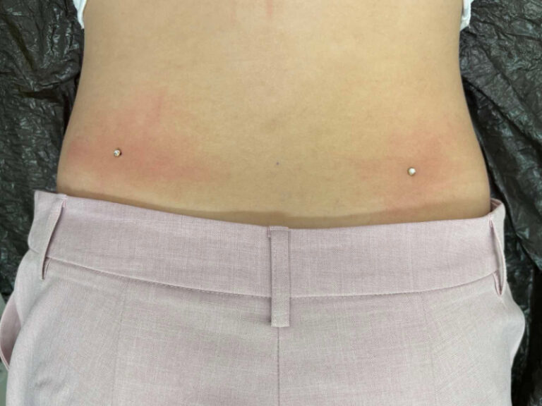 krop-piercing3